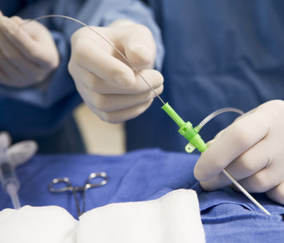 operation-theatre